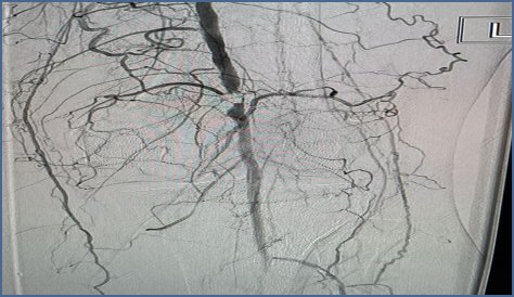 Axel Thors, D.O., F.A.C.S., R.P.V.I.