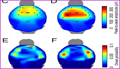 Ultrasound and High Density EEG